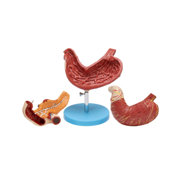 HUMAN STOMACH PANCREAS & DUODENUM - Image 3