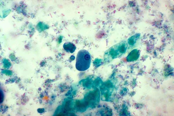 Protozoa